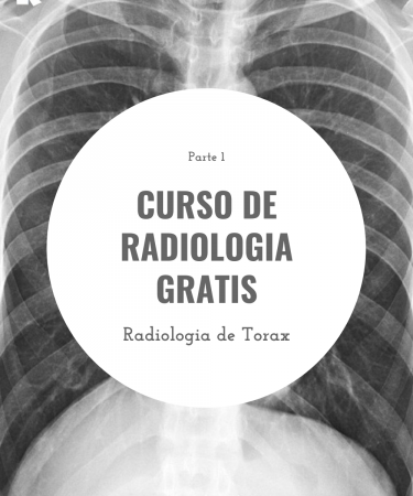 Curso de Radiología Gratis. Radiología de Tórax