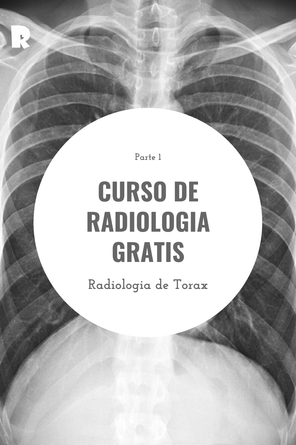Curso de Radiología Gratis. Radiología de Tórax