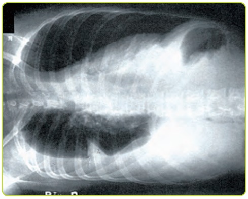 Figura 2. Radiografía en decúbito lateral que evidencia derrame.